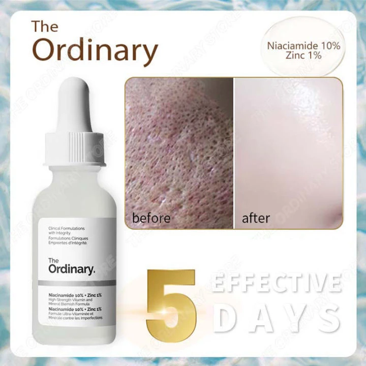 Đánh giá The Ordinary Niacinamide 10% + Zinc 1% The Ordinary